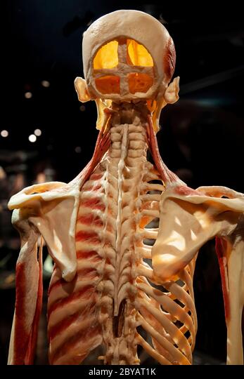 Especimen anatómico humano conservado con estructura esquelética expuesta, músculos y sección del cráneo que revela la cavidad cerebral, parte de la exposición Body Worlds