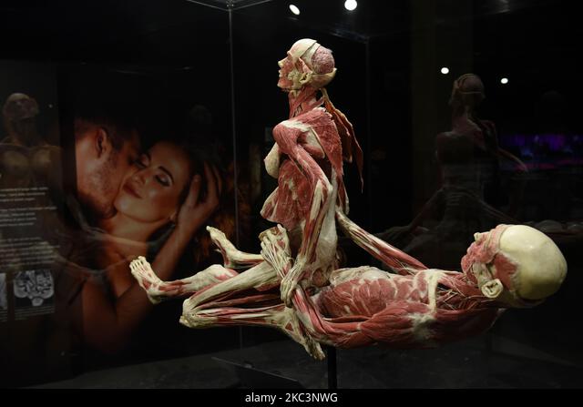 Twee geconserveerde menselijke anatomische specimens in een dynamische opstelling binnen een glazen museumvitrine.