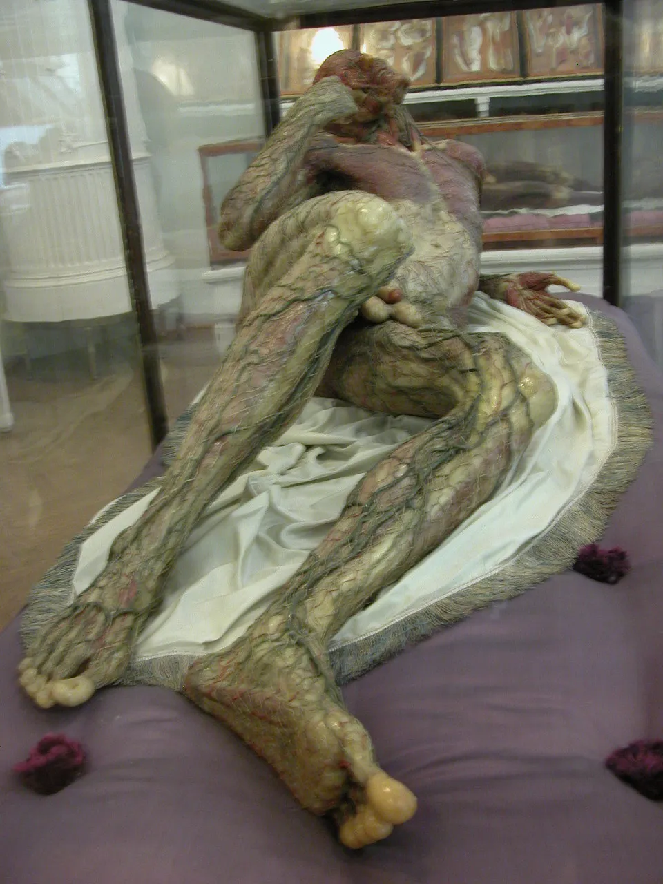 modelo anatómico de cera de una figura humana en una vitrina de cristal