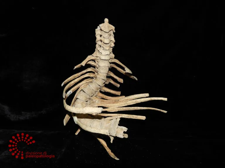 Representative view of Museum of Pathological Anatomy and Paleopathology in Pisa.