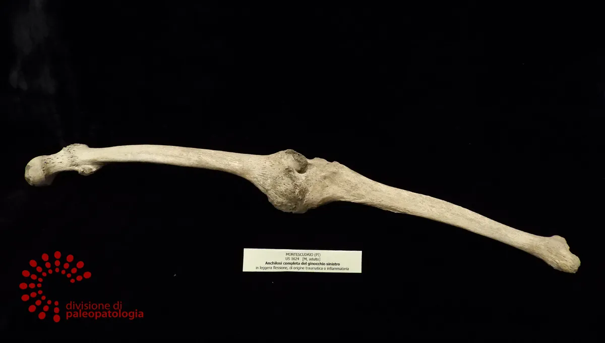 Representative view of Museum of Pathological Anatomy and Paleopathology in Pisa.
