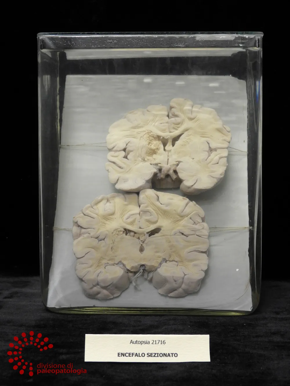 Representative view of Museum of Pathological Anatomy and Paleopathology in Pisa.
