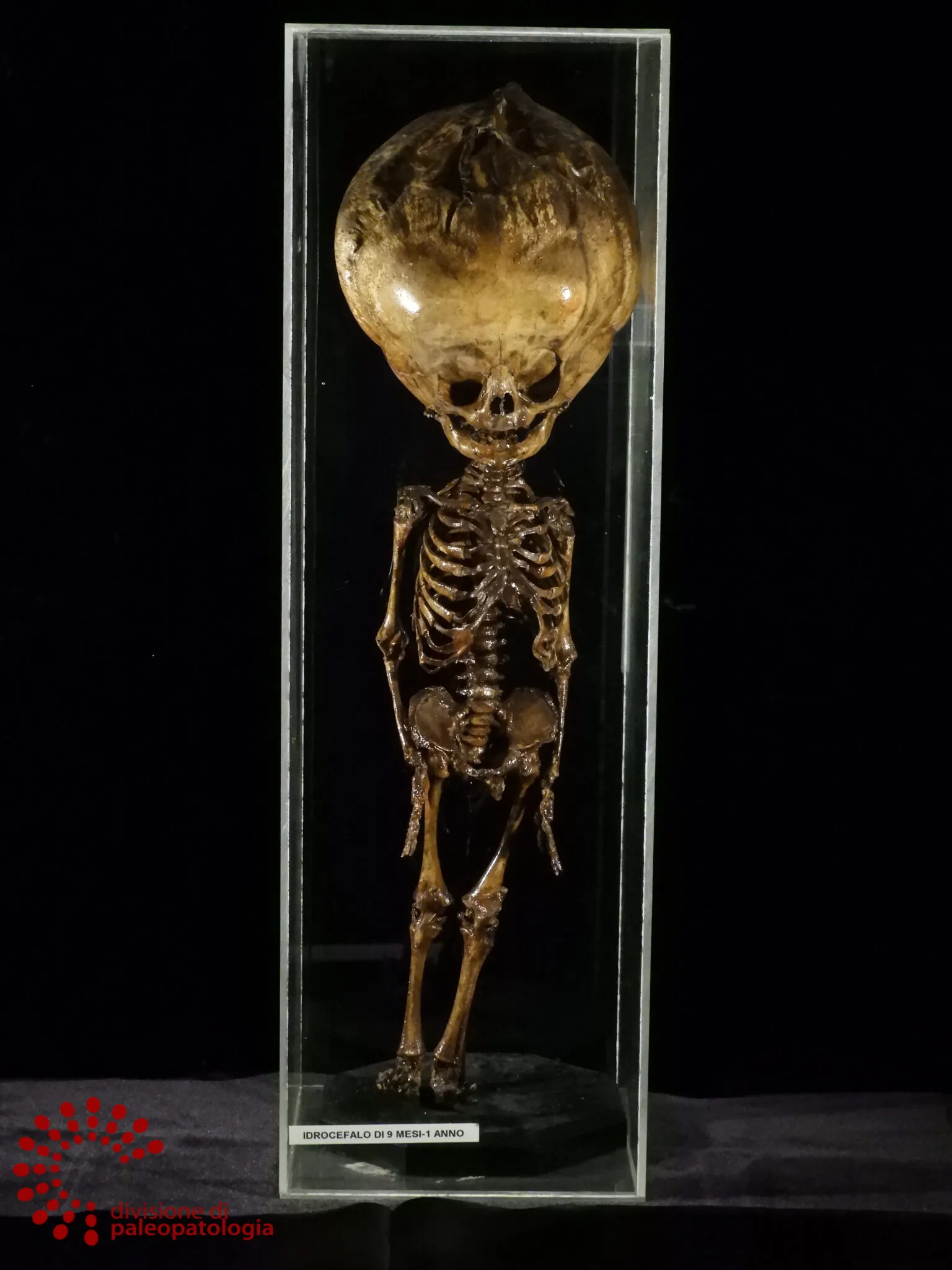 Representative view of Museum of Pathological Anatomy and Paleopathology in Pisa.