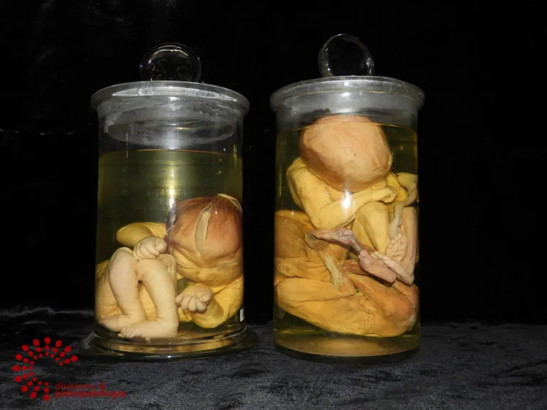Representative view of Museum of Pathological Anatomy and Paleopathology in Pisa.