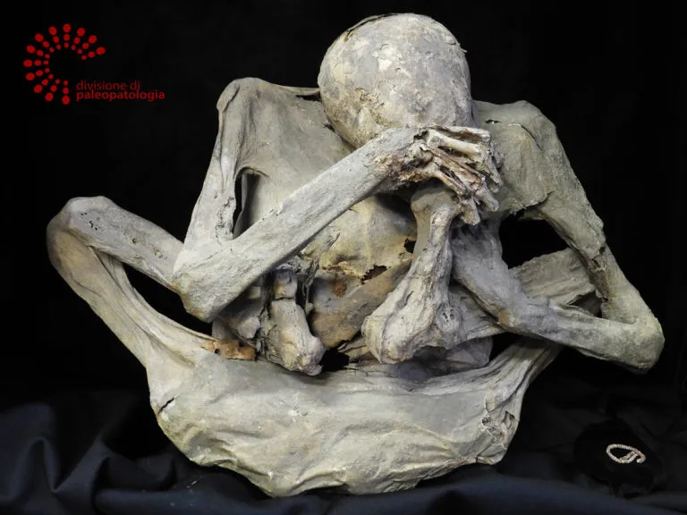 Representative view of Museum of Pathological Anatomy and Paleopathology in Pisa.
