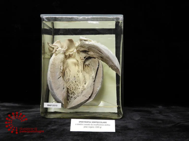 Representative view of Museum of Pathological Anatomy and Paleopathology in Pisa.