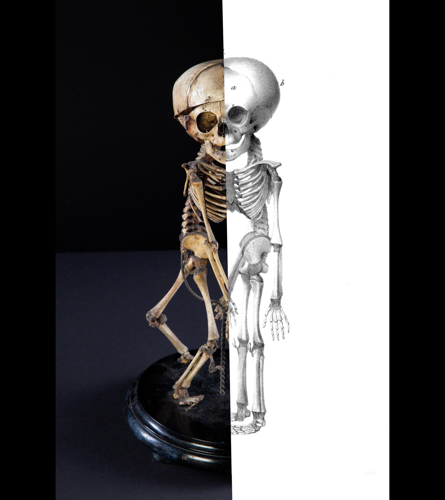 Podzielony eksponat ludzkiego szkieletu z zachowanymi kośćmi po lewej i ilustracją anatomiczną po prawej, charakterystyczny dla kolekcji Muzeum Vrolik