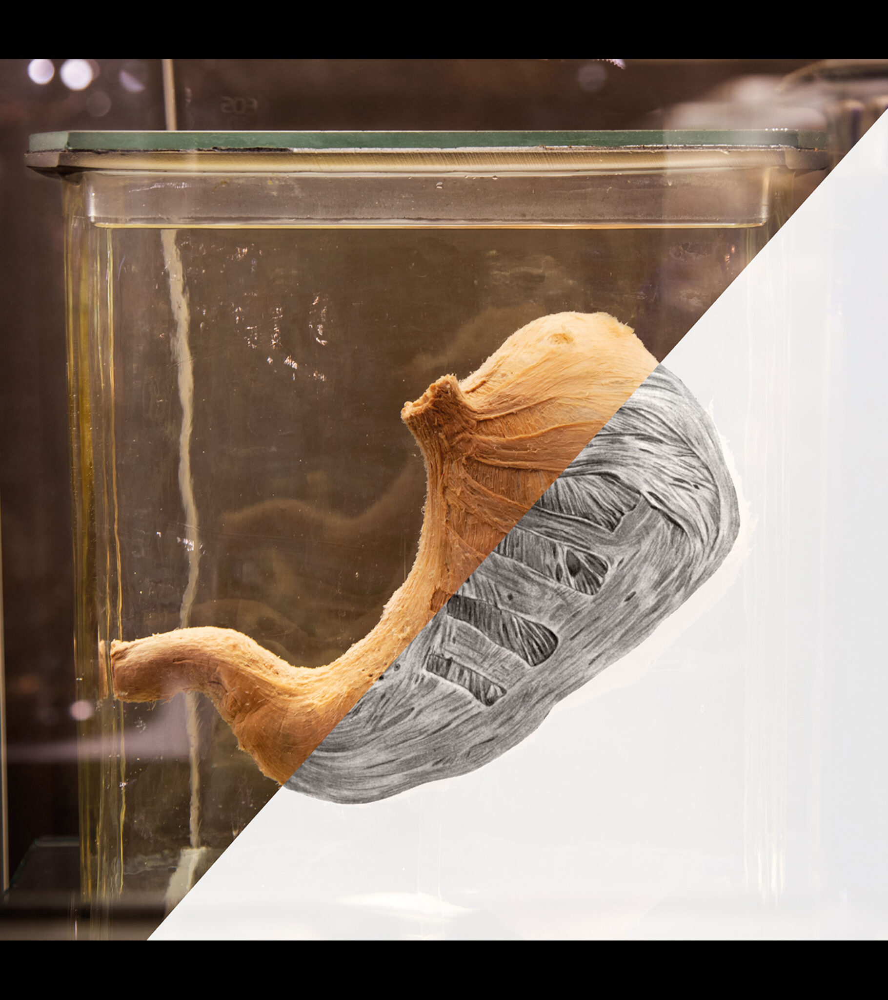 Preparat anatomiczny zachowany w płynie w szklanym słoiku, ukazujący szczegółowe struktury tkankowe w beżowo-szarej kolorystyce na neutralnym tle