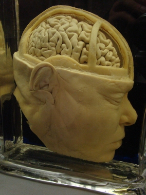 Zachowany ludzki okaz głowy z odsłoniętym mózgiem w szklanej gablocie, ukazujący cechy anatomiczne