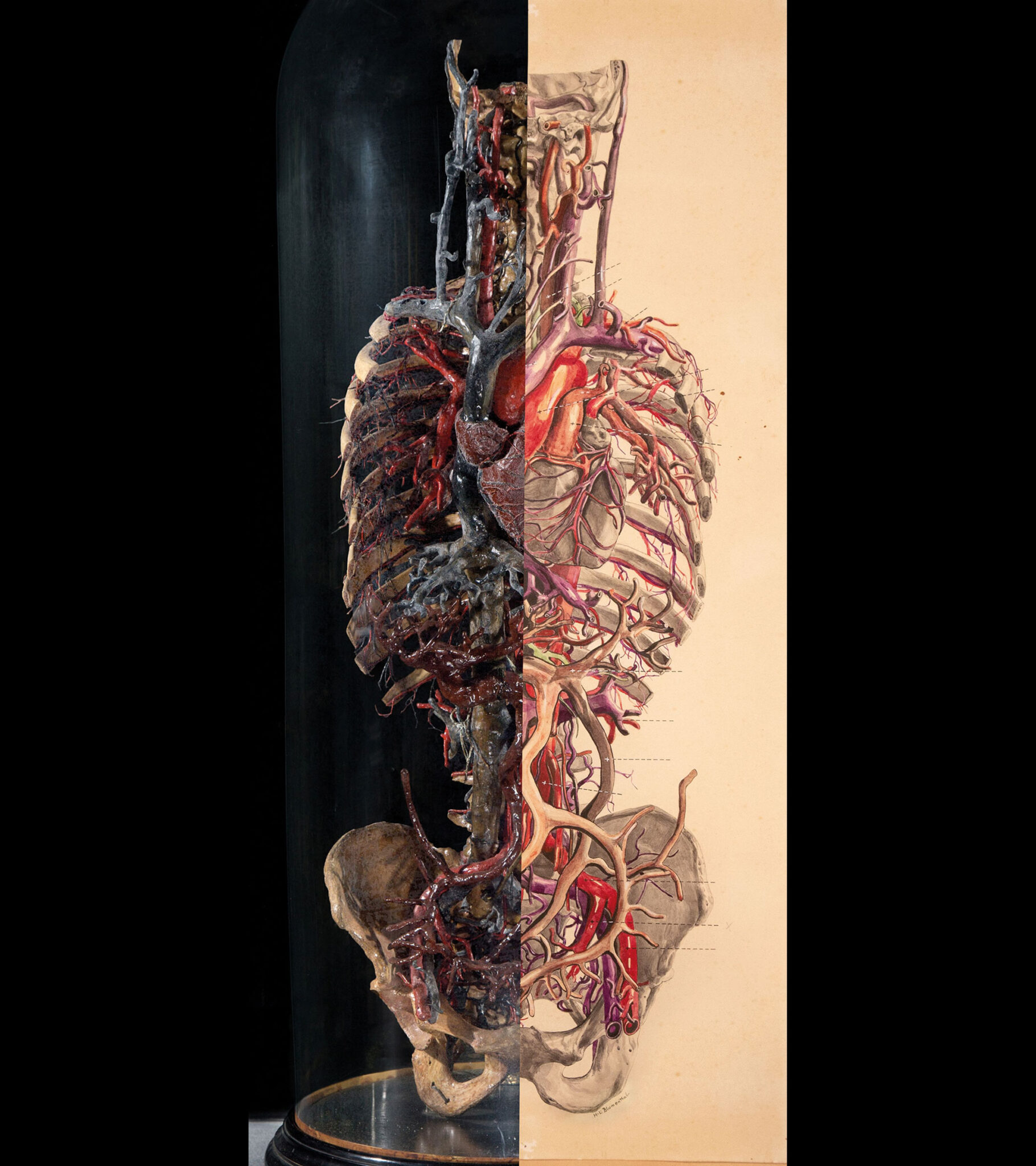 Anatomical specimen with detailed vascular system and organs in a glass display case against black and beige background